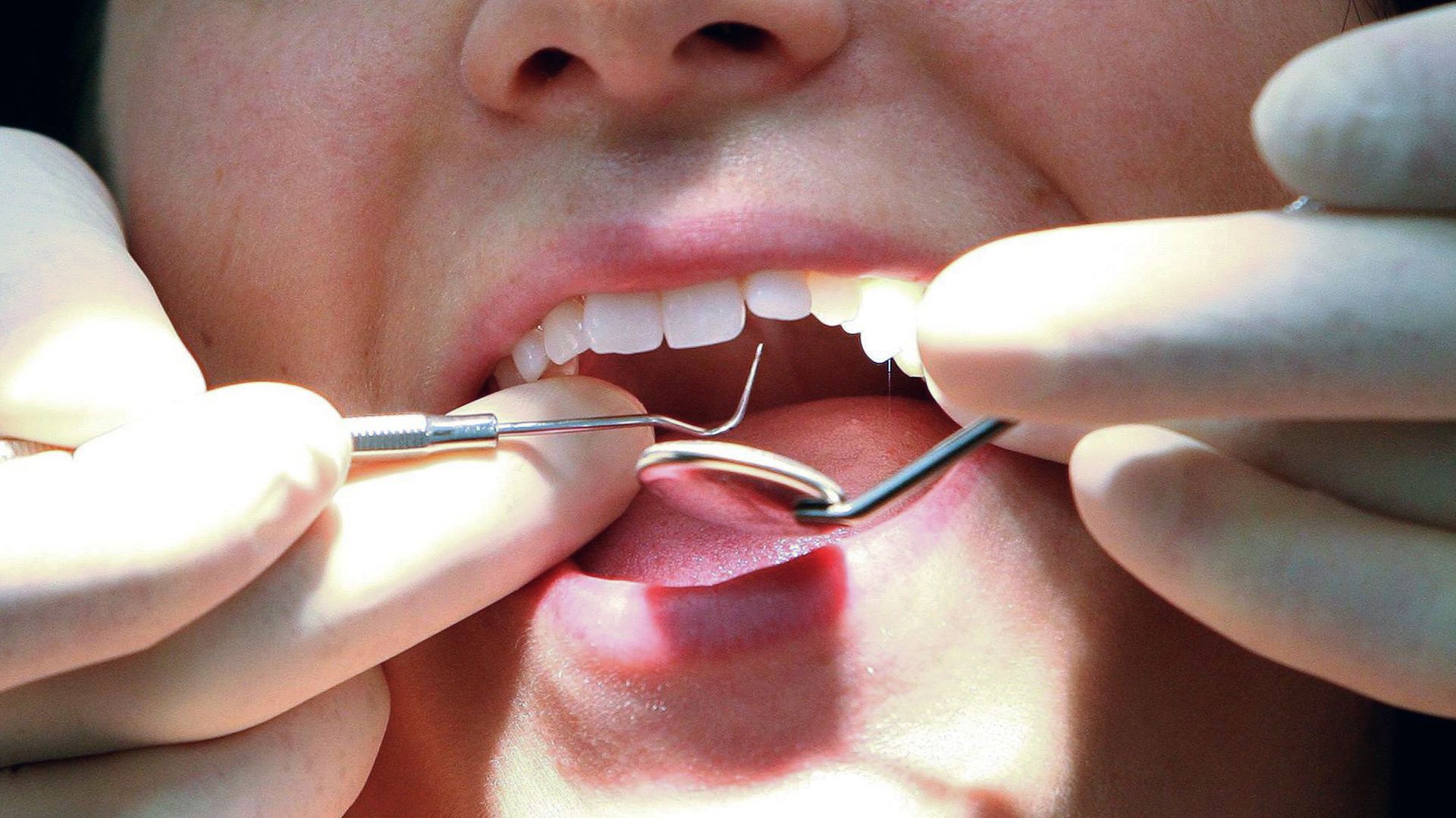 £8bn private dentistry industry to be investigated after 'significant' price hikes