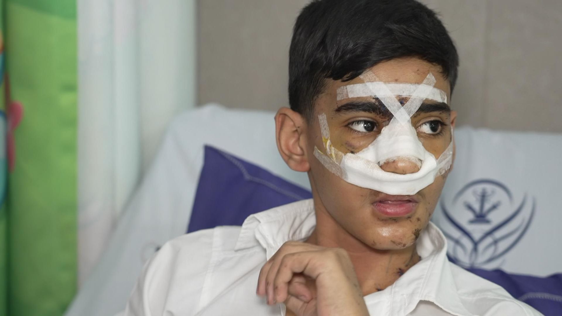 Inside Iran's children's wards: The painful human cost of US-Israel airstrikes