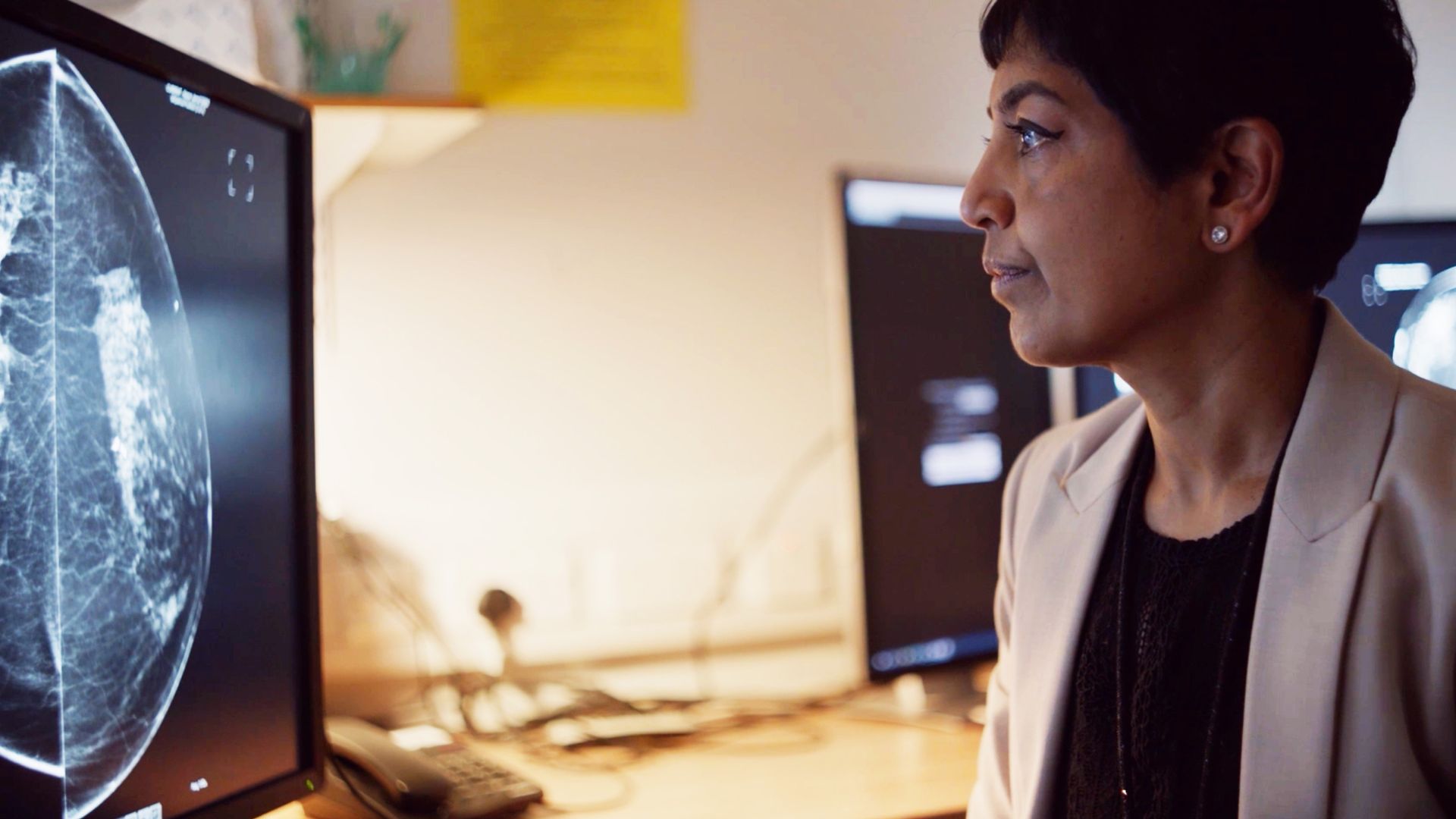 How AI can identify breast cancer 'better' than a doctor but there's a catch