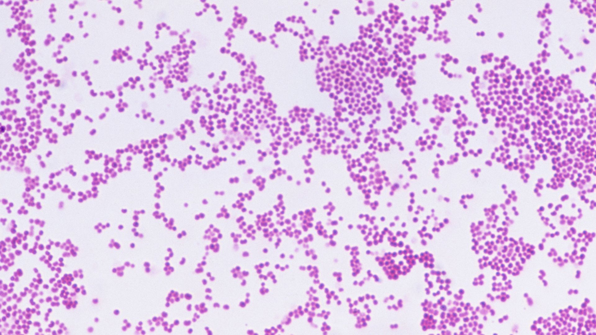 Kent meningitis outbreak a cruel reminder young people most at risk